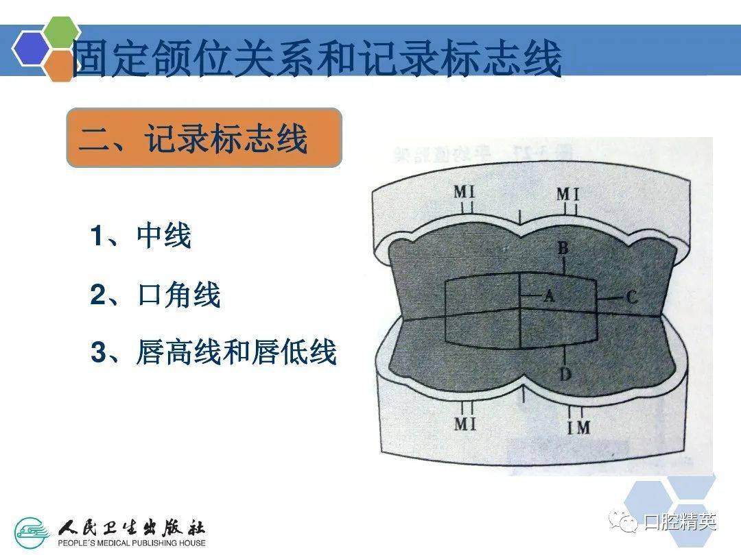 全口义齿印模制取及颌位关系记录