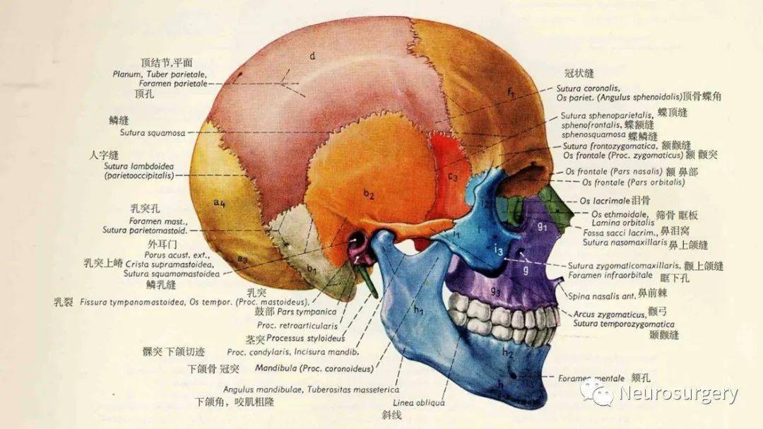 颅骨孔裂图片