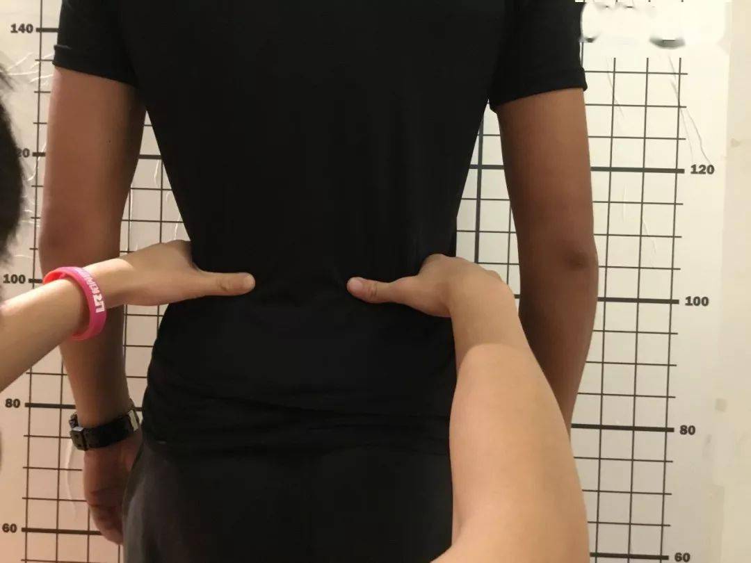 臀中小肌与腰痛