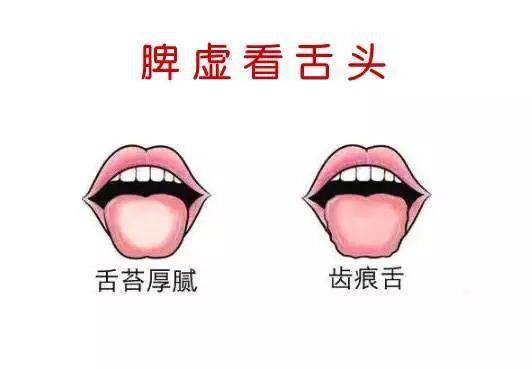 最全中医舌诊图谱来啦!看舌头,知全身!_舌苔