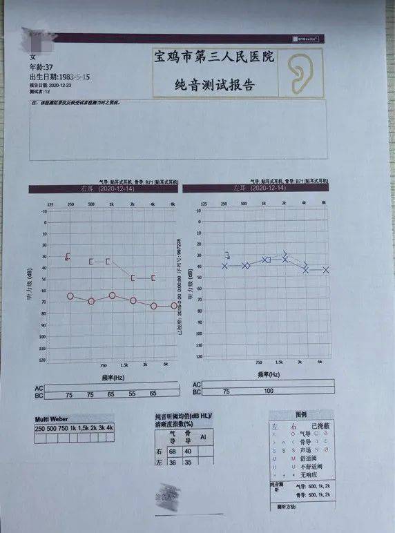 警惕年底突发性耳聋高发原因竟是因为它