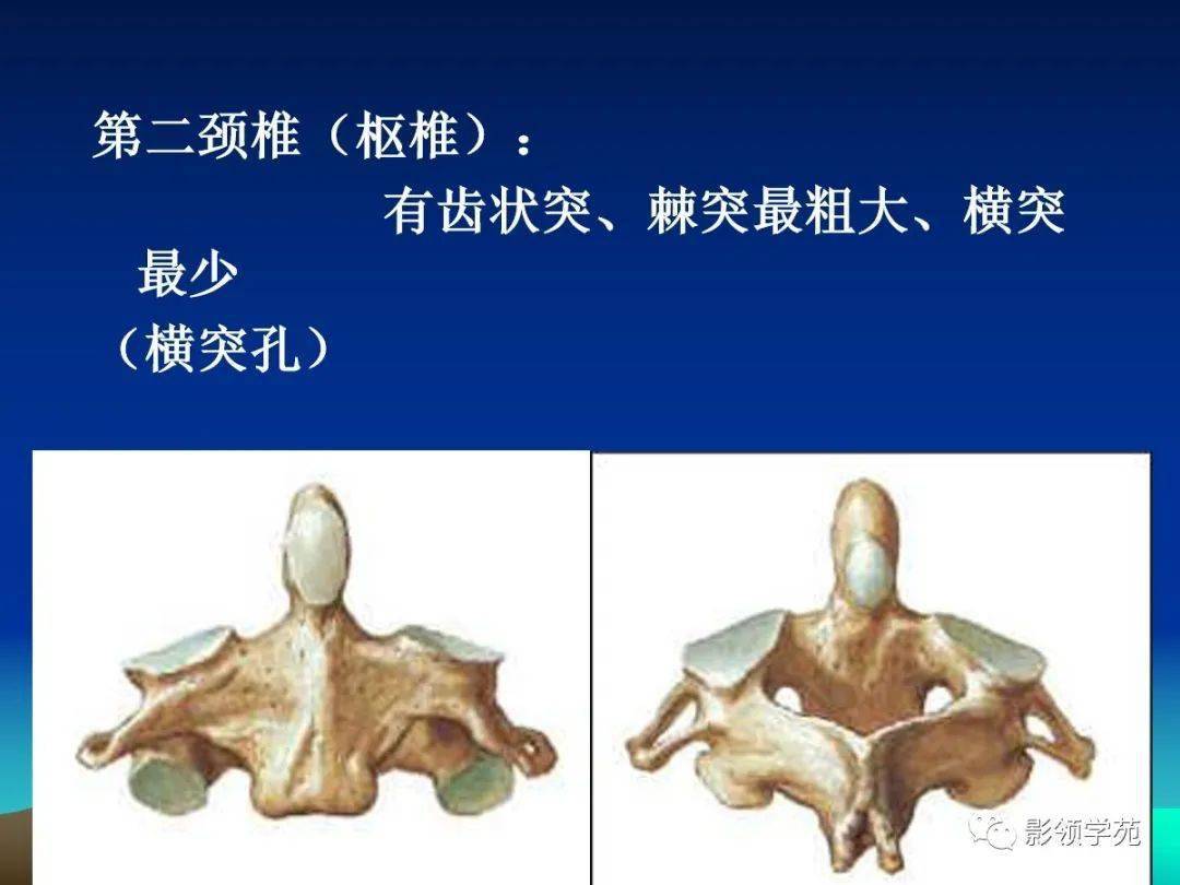 頸椎精細解剖及相關疾病影像表現