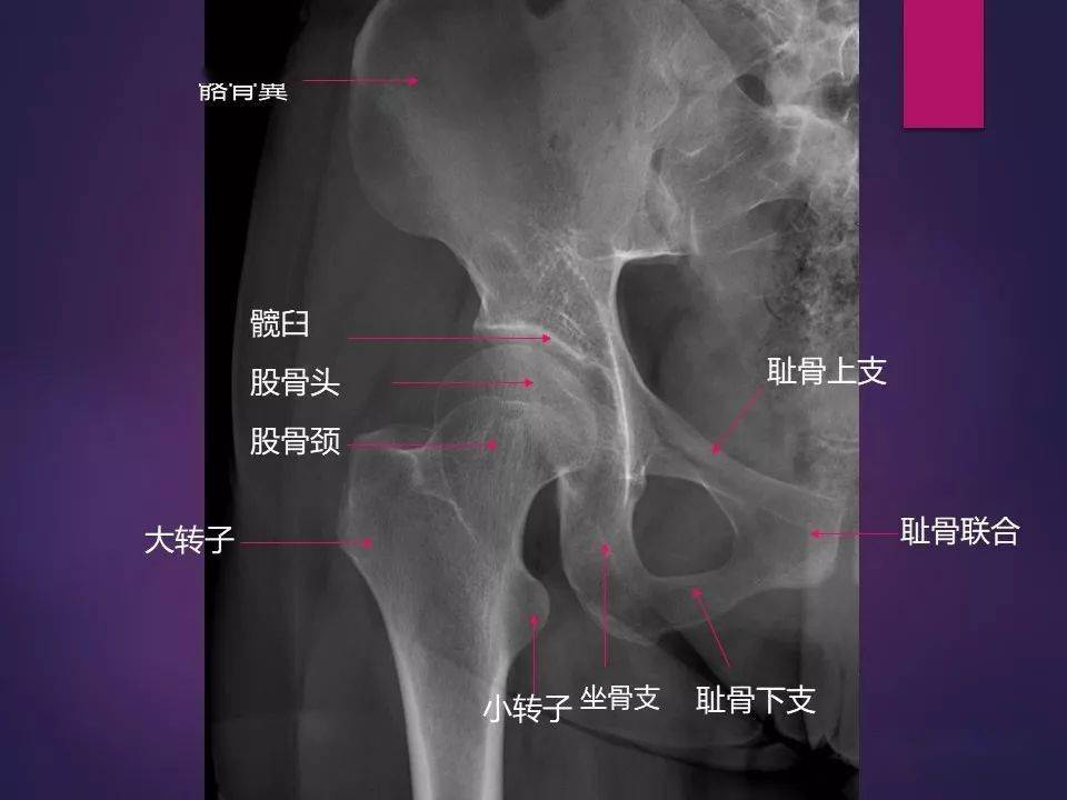 67经典不能错过骨肌系统影像解剖案前必备