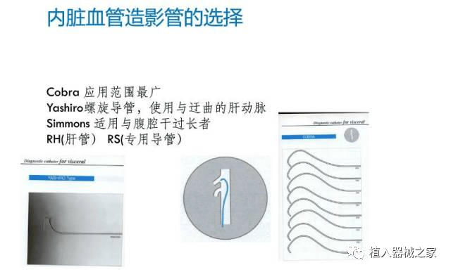 图解介入手术器械大全