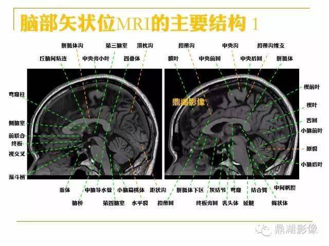 值得收藏高清头颅mr解剖图谱