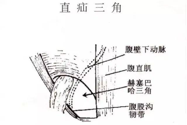 腹股沟三角解剖画图图片