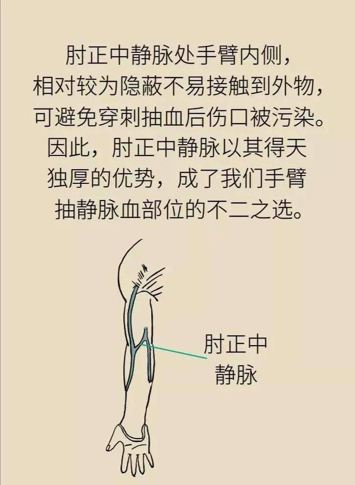 手臂放血的位置示意图图片