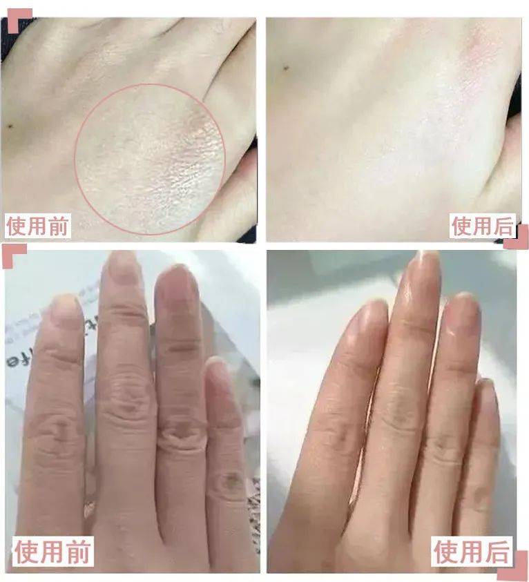 长效抵御干燥的空气,敷一次堪比涂抹十支手足霜~ 放大对比仔细看,手上