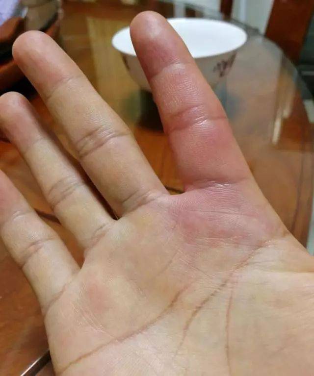 咸淡水交界处钓到一种叫"唱歌婆"的鱼,不敢用手去碰