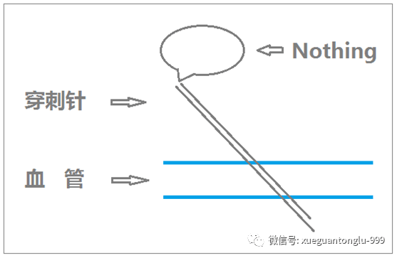 (5)针尖穿刺过血管前后壁.