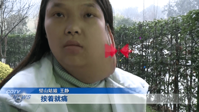 脖子上长出巨大囊肿谁能帮帮这个可怜女孩