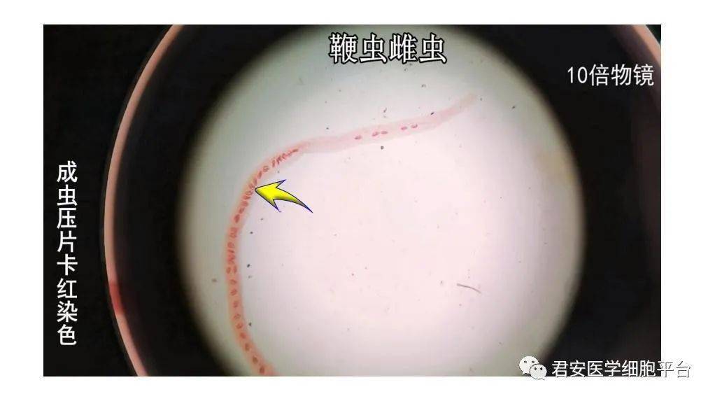 鞭虫卵显微镜下图图片