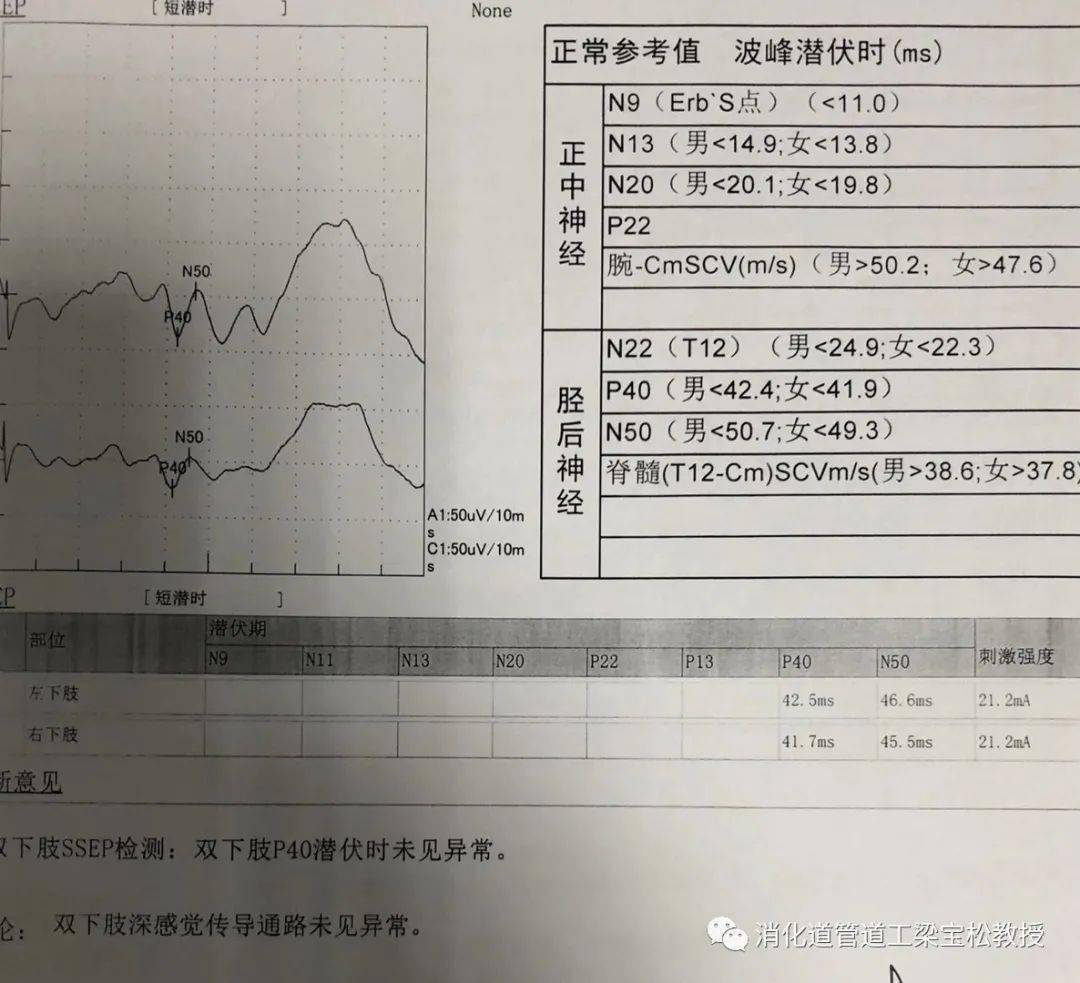 究竟是漸凍症還是心理障礙