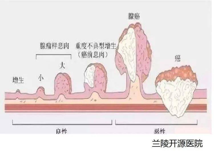 怎么判断自己有没有必要做肠镜 471569df232f40fe87cba8d8336c06ee.jpeg