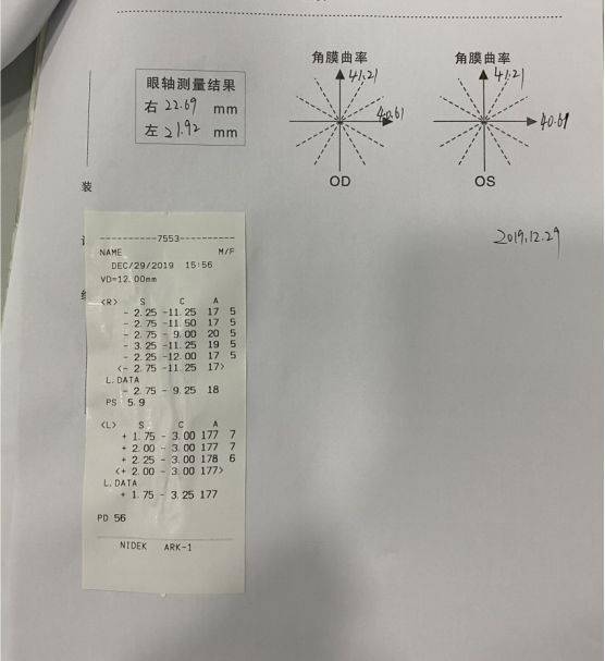 初步問診姓名,年齡5歲,視力下降三年,已配鏡半年是遠視散光眼鏡,原