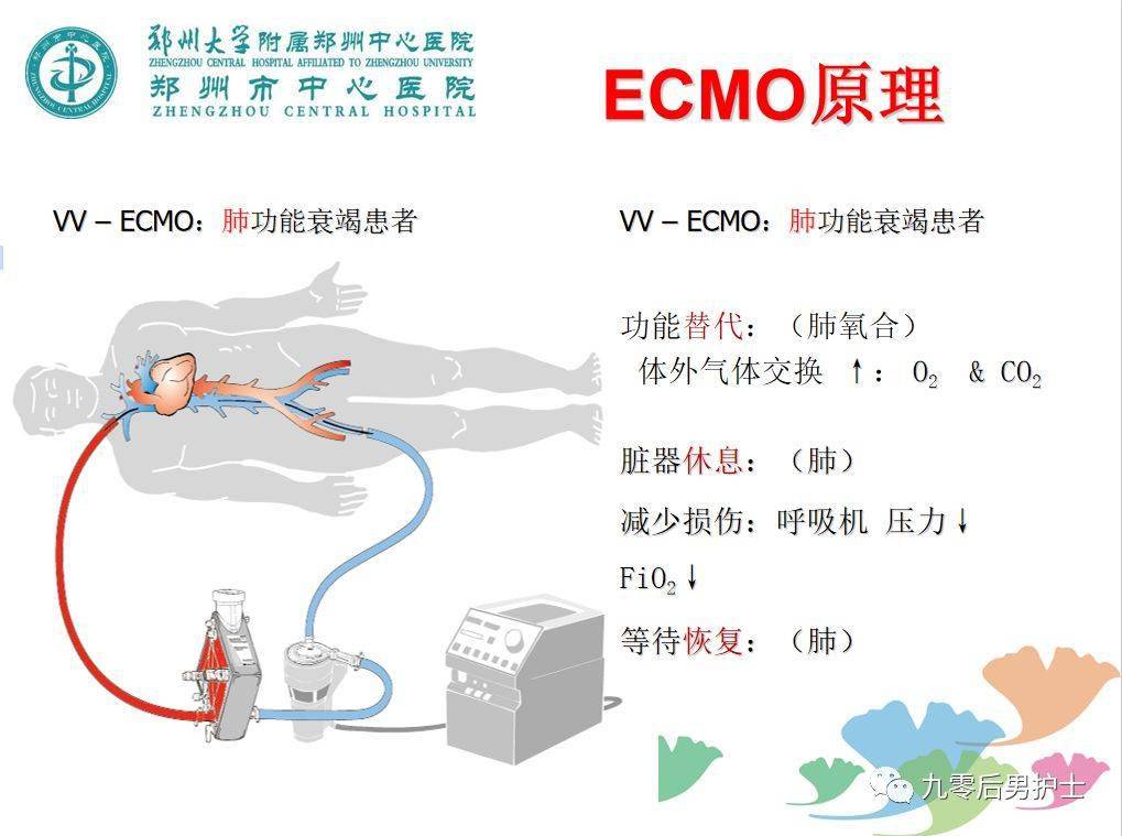 ecmo患者如何护理这几点重点提示你一定要看看