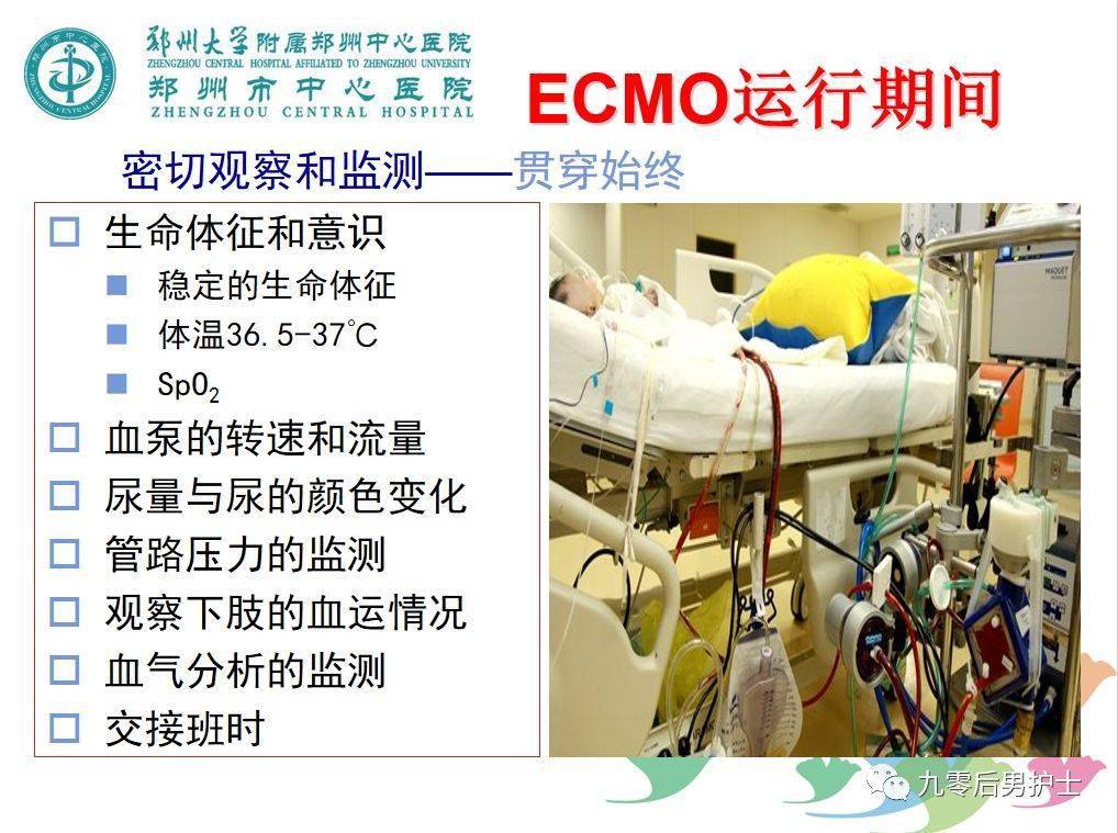 ecmo患者如何护理这几点重点提示你一定要看看