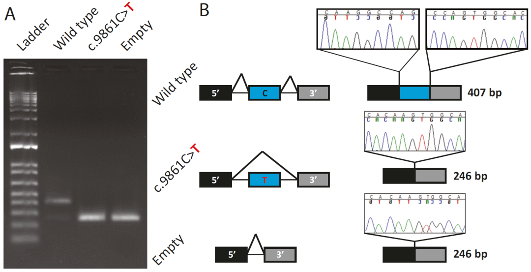 文献解读myo15a基因上的同义突变引起剪接异常从而导致常染色体隐性