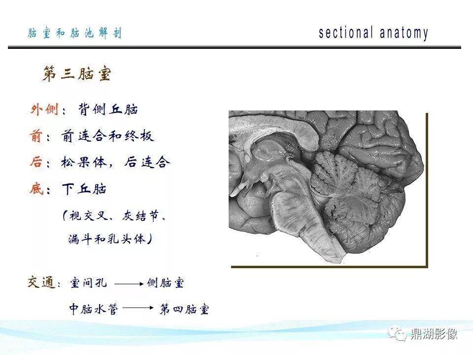 超全详解脑池和脑室断层解剖