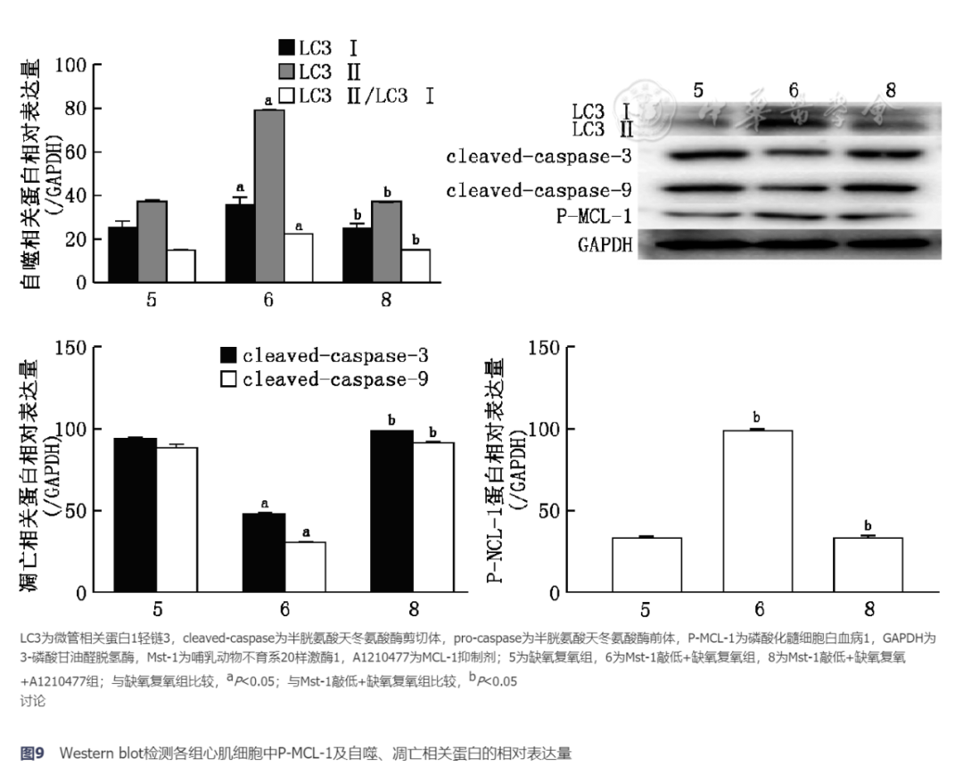 p62蛋白 来自搜狐网
