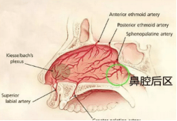 一医专家告诉你"流鼻血"的真相!_鼻腔