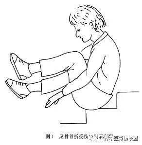 尾骨骨折与脱位 肛门