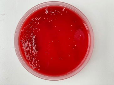 产气荚膜梭菌血平板图片