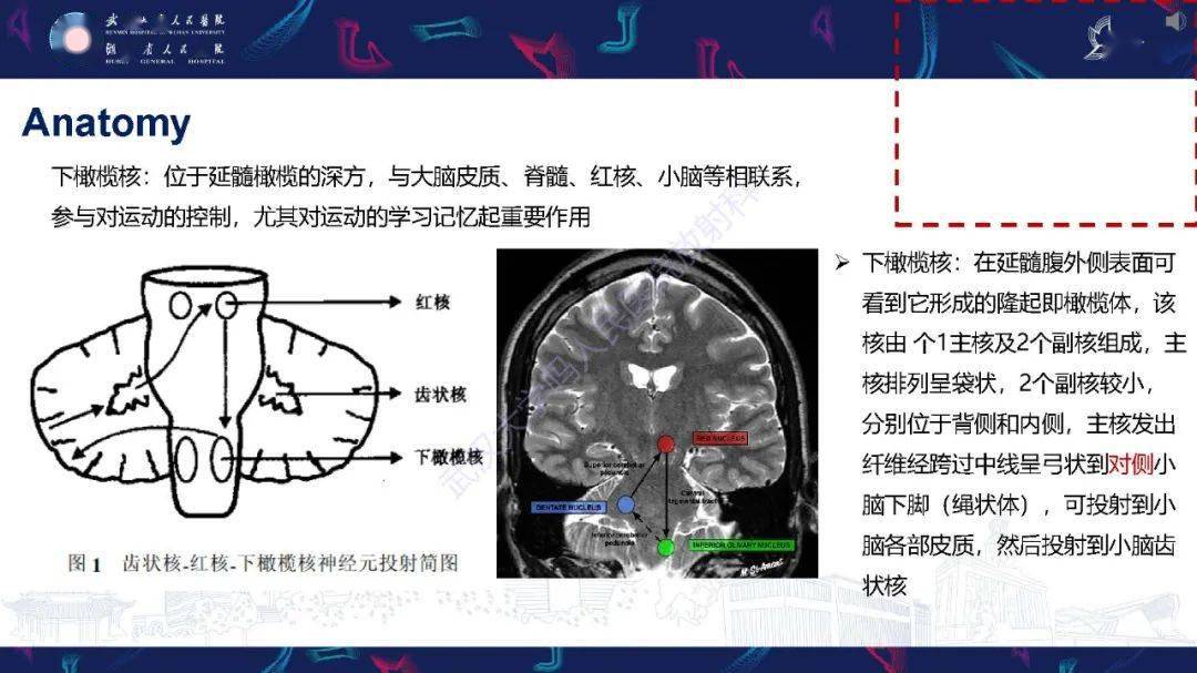 橄榄体解剖图片