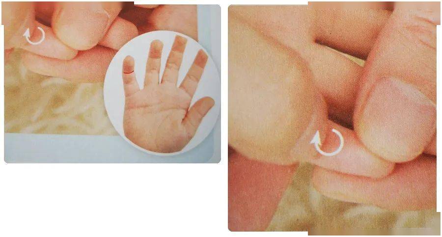 儿童霰粒肿按摩手法图图片