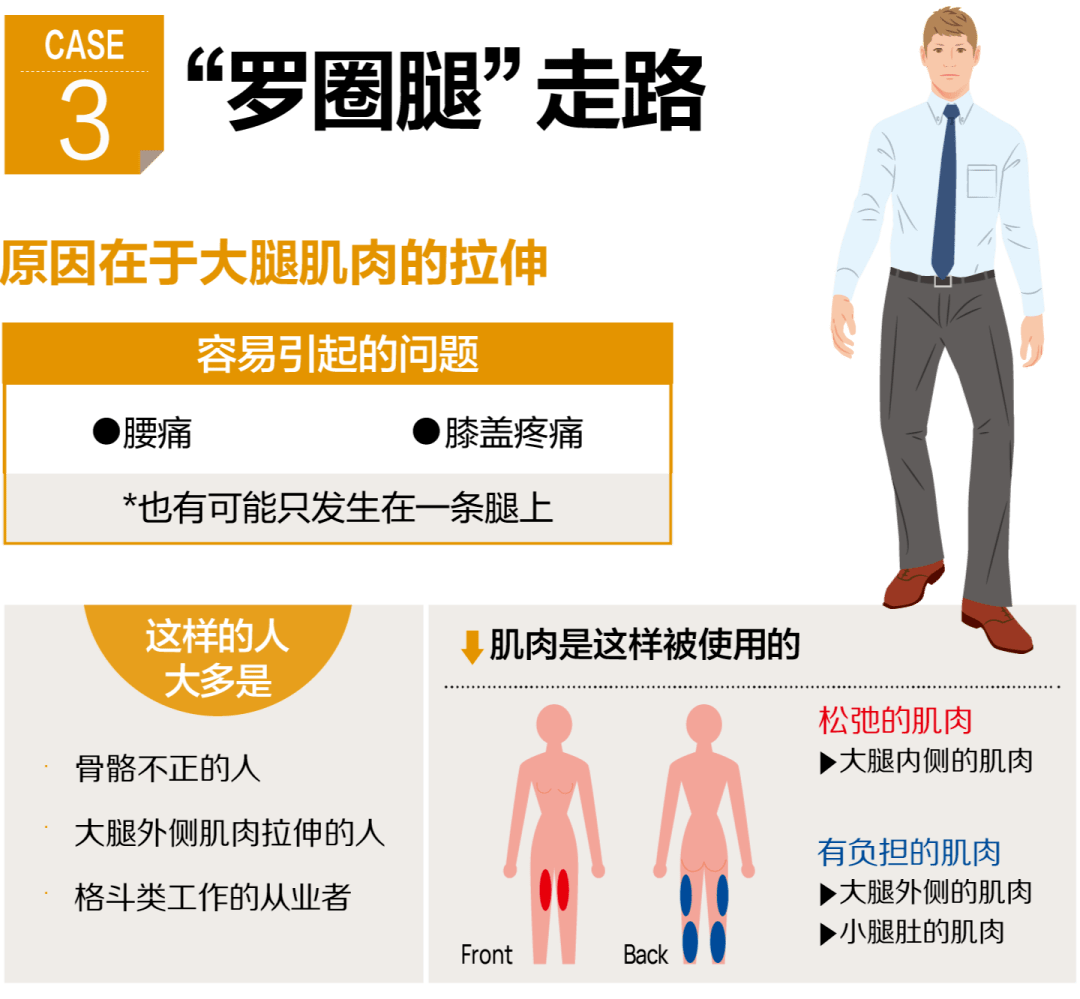 骨盆人口右倾斜经_骨盆倾斜图片(3)