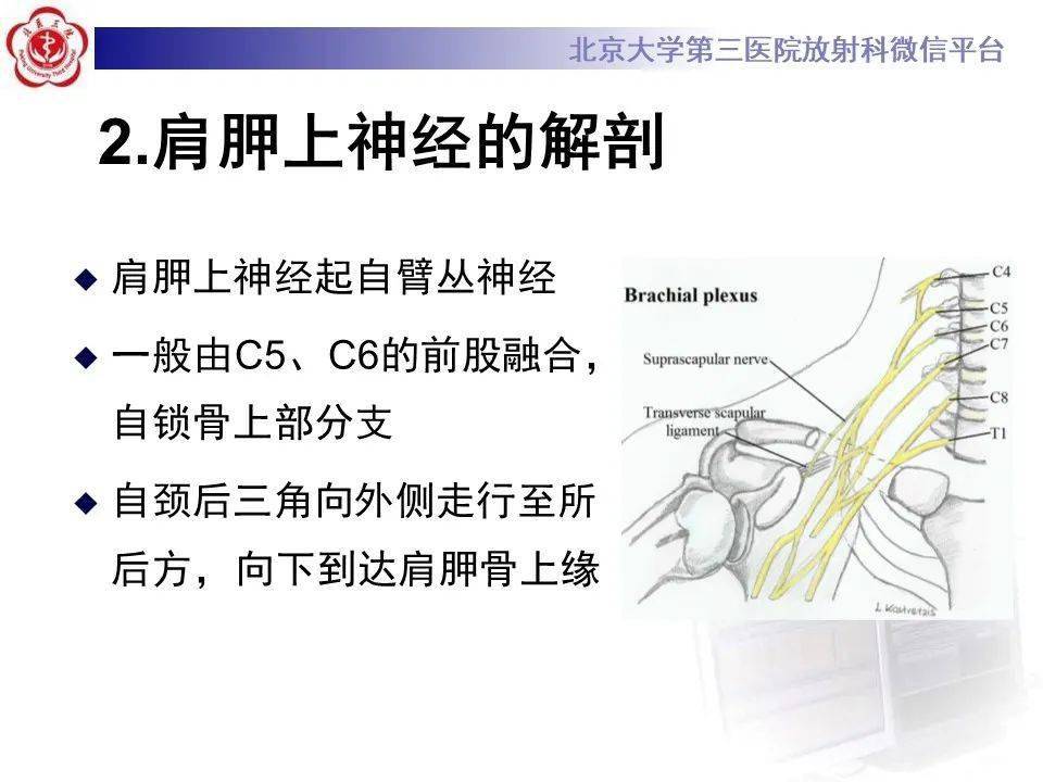 肩胛上神经卡压影像表现