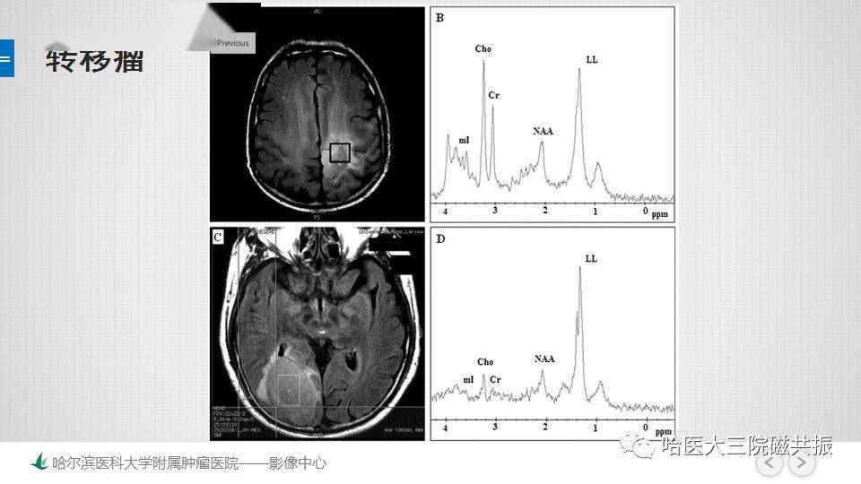 磁共振的原理是什么