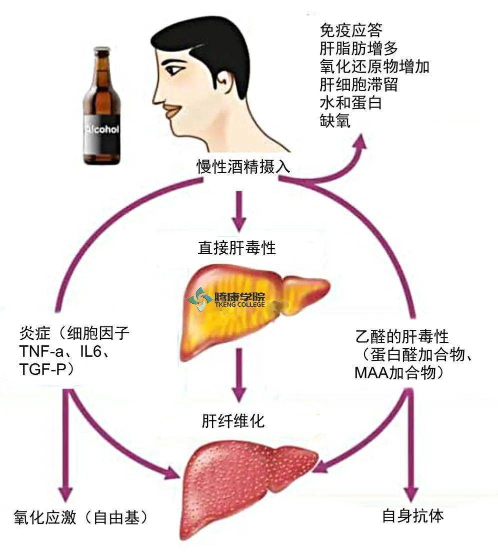 脂肪肝可能會出現這些症狀