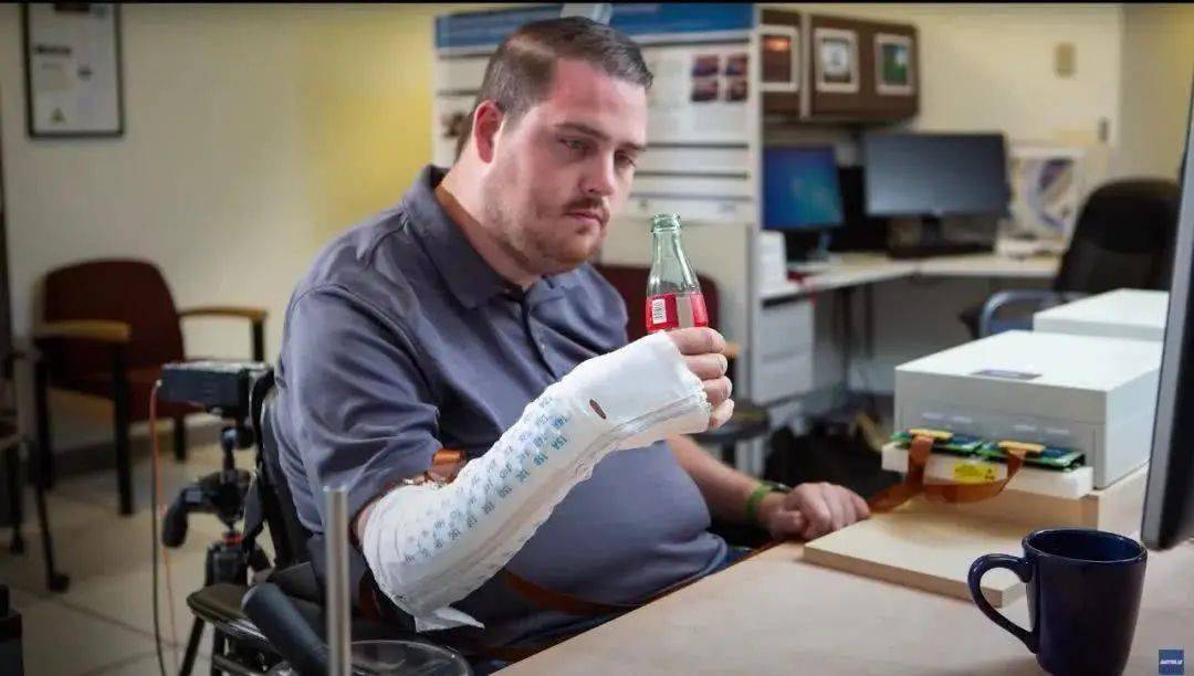 进行性肌萎缩是不是渐冻症 8f5bc6de61ce45628dd9e7c9a68a02fd.jpeg