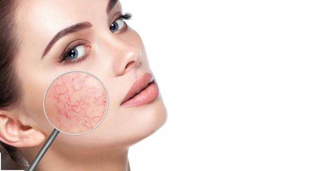 皮肤修复屏障是什么意思 9a22dc61a6dd437ab9bce8ecf105be5e.jpeg