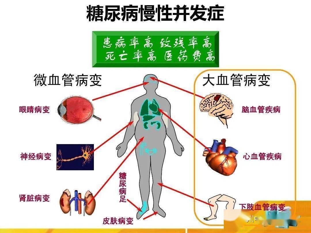 刘阿姨住院以后,我科进行针对性并发症评估,除了糖尿病眼底,肾脏,血管