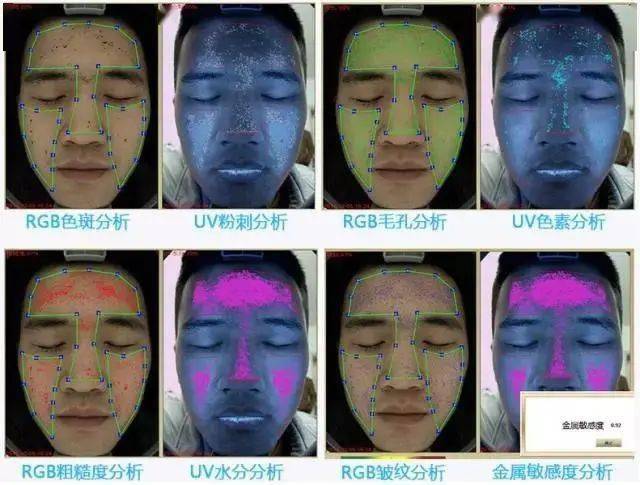 光斑,黄褐斑,红血丝,皱纹,皮肤纹理,毛孔,粉刺这八大问题