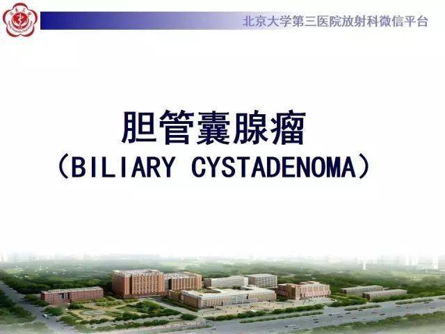 【每日一例1326】28岁女性,体检发现胰腺头占位267_陈美林