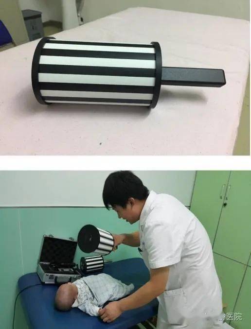 图表 1 视动性眼震检查优先注视法220世纪50~60年代,心理学家发现,与