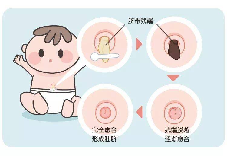 看更多肚脐只有 10 的人是凸肚脐凹肚脐最常见常见的肚脐