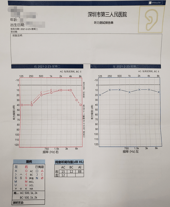 听力检查报告正常图片图片