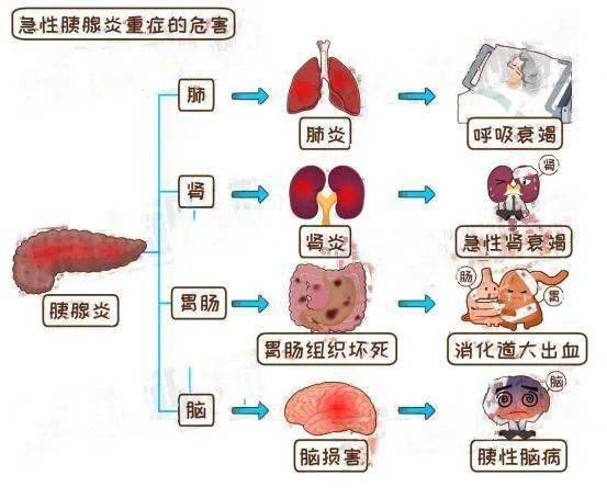 干饭人的灾难,急性重症胰腺炎您了解么?
