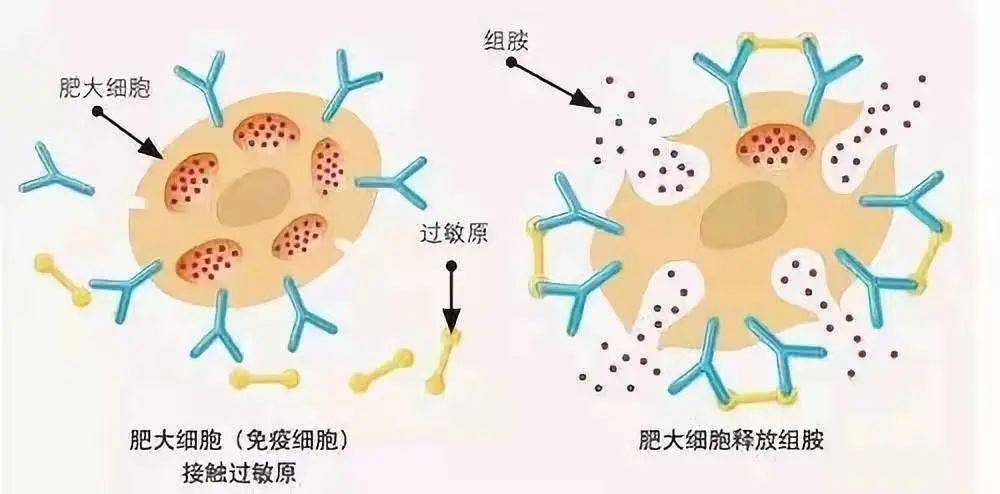 當人體接觸過敏源產生過敏反應時,人體的肥大細胞和嗜鹼性粒細胞會被