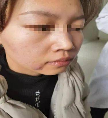 小小揿针功能强大巧治皮肤病