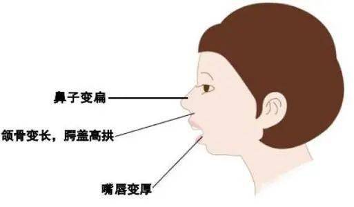 与人口角后突发呼吸困难_呼吸困难图片