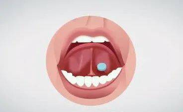 舌下含服 硝酸甘油图片