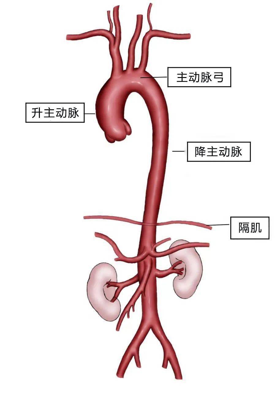 正常的腹主动脉及双髂动脉医生考虑到,王大爷很可能是因为胸腹主动脉