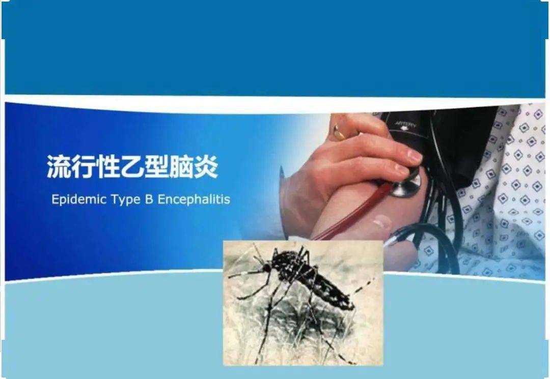 流行性乙型脑炎(日本脑炎):是由乙脑病毒引起的自然疫源性疾病,经蚊媒