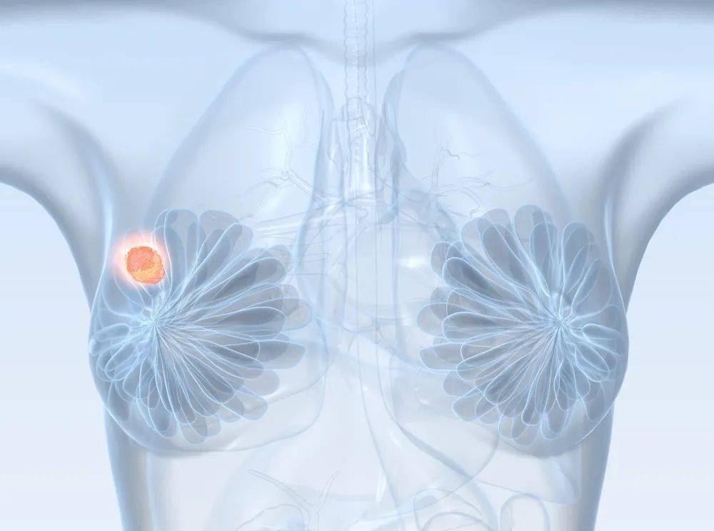 乳腺纤维腺瘤会癌变吗?要手术吗?