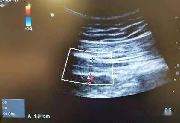 疼痛科怎么理疗拍片子都找不出原因的肩颈腰腿痛，只能忍着吗？_https://www.jmylbn.com_新闻资讯_第3张